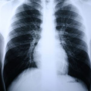 MCKESSON BRAND Clear Choice™ Performance X-Ray Film 55BN7