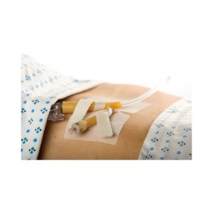 M.C. JOHNSON Cath-Secure® Dual Tab Catheter Holder 5445-4