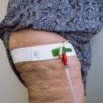 DALE MEDICAL PRODUCTS Dale® Leg Strap/Waist Band, holds Catheter, fits legs and waists up to 56 Inches 330