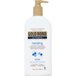 CHATTEM Gold Bond® Healing Hydrating Lotion With Aloe, 14-ounce Pump Bottle 04116706651