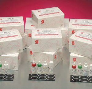 STANBIO LABORATORY RaPET® RF Rheumatoid Factor Latex Agglutination Autoimmune Test Kit 1155-050
