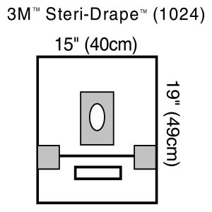 SOLVENTUM CORPORATION 3M™ Steri-Drape™ Sterile Small Aperture EENT Drape, 15 x 19 Inch 1024
